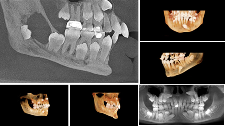 Radiographie